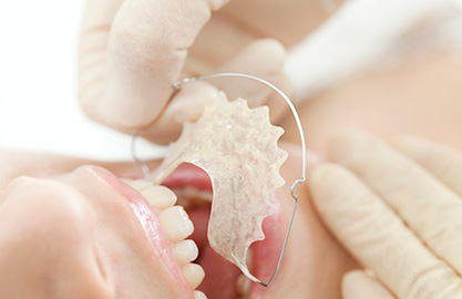 中区丸の内・みずの歯科医院・矯正歯科・小児矯正歯科